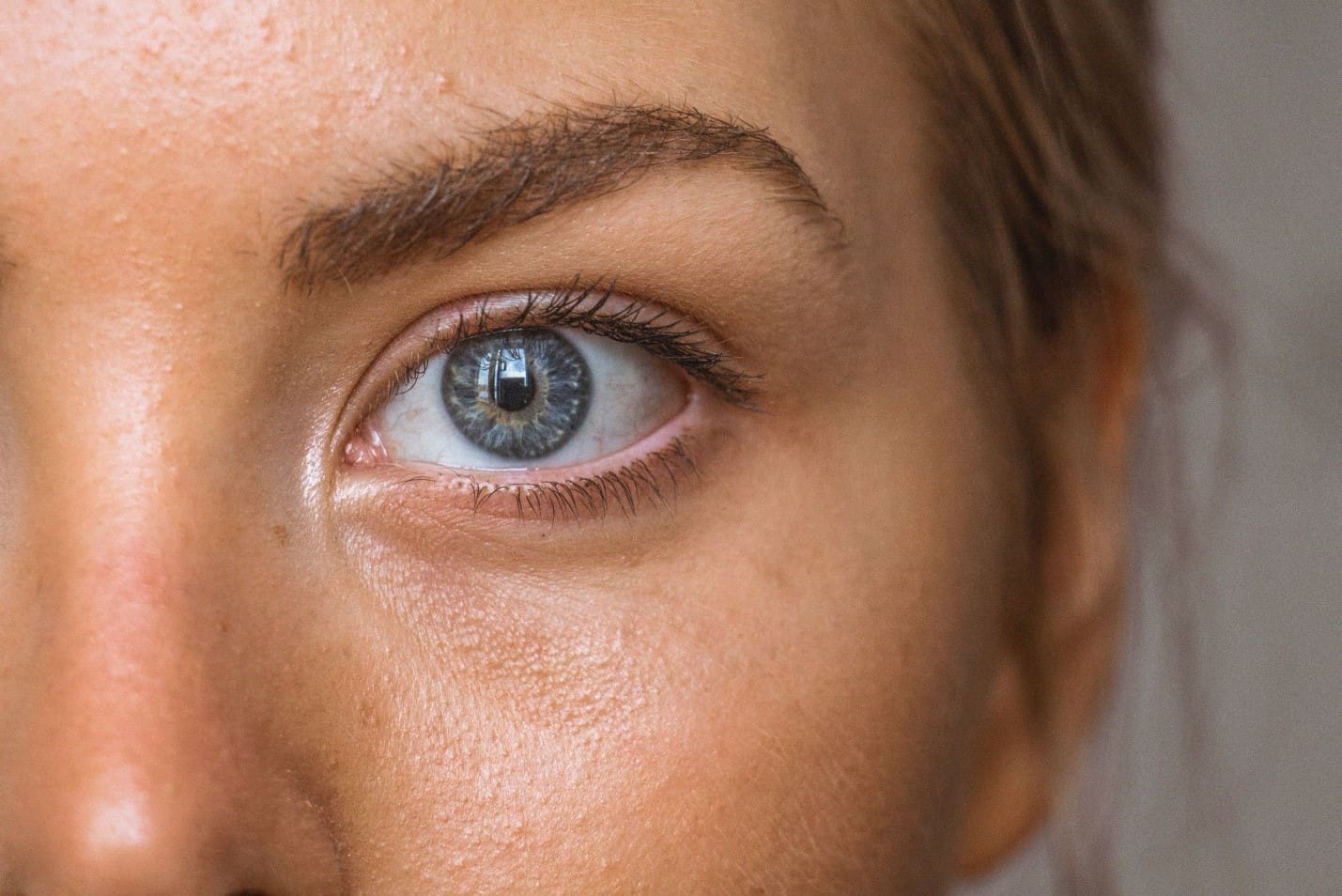 suncoast Photodynamic Therapy - Suncoast Skin Solutions Photodynamic Therapy